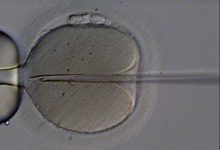 in-vitro_m-5262805