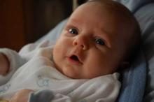 zespol-turnera-objawy_m-3790976